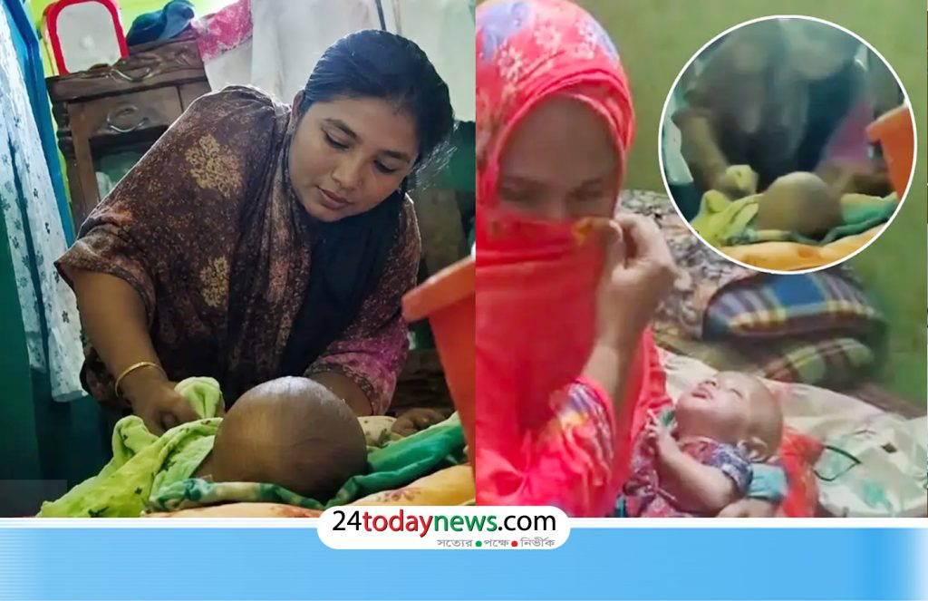 ৩ মাসের ‘শিশুর পা ভাঙার’ ভিডিও ভাইরাল, যা বলছে পরিবার