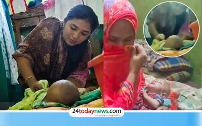 ৩ মাসের ‘শিশুর পা ভাঙার’ ভিডিও ভাইরাল, যা বলছে পরিবার