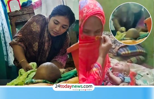 ৩ মাসের ‘শিশুর পা ভাঙার’ ভিডিও ভাইরাল, যা বলছে পরিবার